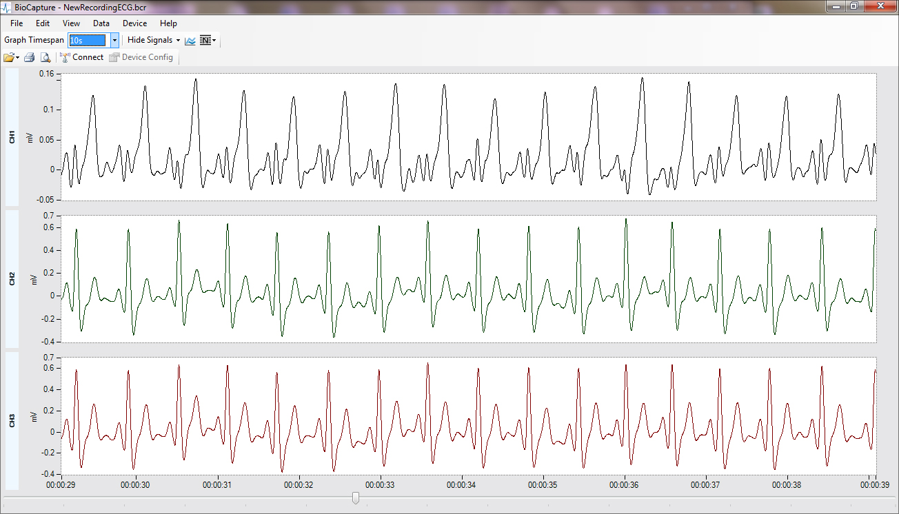 Mobile & Wireless ECG Systems