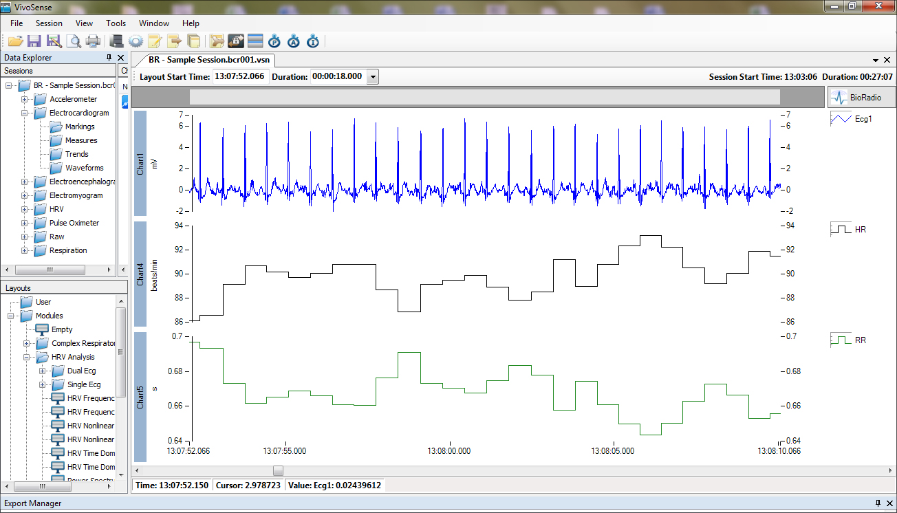 Mobile & Wireless ECG Systems
