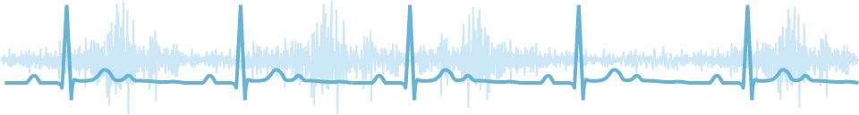 wireless physiological monitor