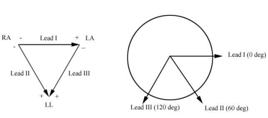 ECG Electrode placement