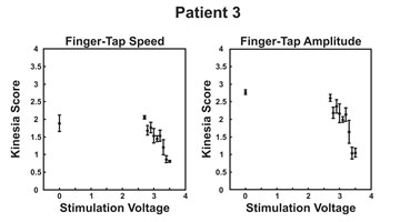 Finger tap speed and amplitude